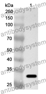 Anti-Human WRAP53 Polyclonal Antibody