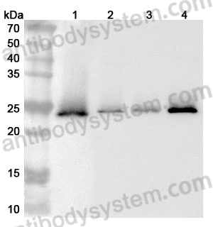 Anti-Human TMED9 Polyclonal Antibody