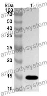 Anti-Human COLEC11 Polyclonal Antibody