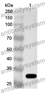 Anti-Human KDM5D Polyclonal Antibody