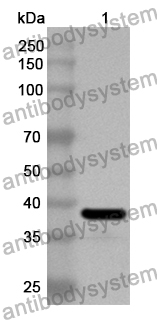 Anti-Human ZDHHC5 Polyclonal Antibody