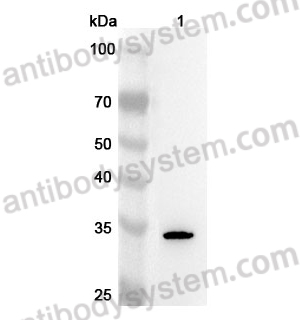 Anti-Human GSTO2 Polyclonal Antibody