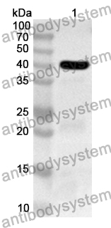 Anti-Human MKNK2 Polyclonal Antibody