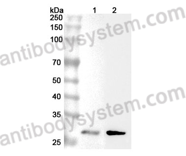 Anti-Human TIGAR Polyclonal Antibody