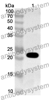 Anti-Human ANO2 Polyclonal Antibody