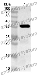 Anti-Human PAK6 Polyclonal Antibody