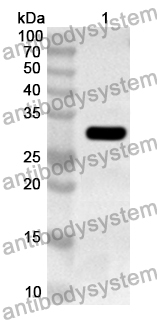 Anti-Human PNPLA3 Polyclonal Antibody