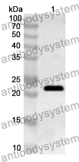 Anti-Human INTS10 Polyclonal Antibody