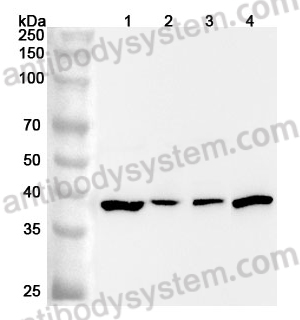 Anti-Human SAE1 Polyclonal Antibody