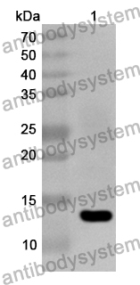 Anti-Human DNAH17 Polyclonal Antibody