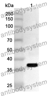 Anti-Human FBXW2 Polyclonal Antibody