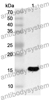 Anti-Human CCPG1 Polyclonal Antibody