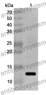 Anti-Human NOB1 Polyclonal Antibody