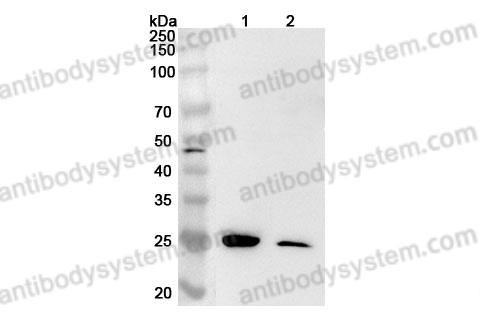 Anti-Human RTRAF Polyclonal Antibody