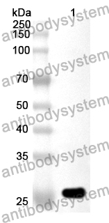 Anti-Human DIS3 Polyclonal Antibody