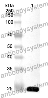 Anti-Human SAR1B Polyclonal Antibody