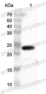 Anti-Human SYNGAP1 Polyclonal Antibody