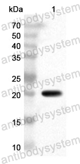 Anti-Human KAT2B Polyclonal Antibody