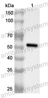 Anti-Human OTUD1 Polyclonal Antibody