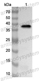 Anti-Human ASPM Polyclonal Antibody