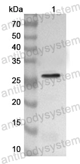 Anti-Human ASPM Polyclonal Antibody