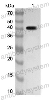 Anti-Human SGK3 Polyclonal Antibody