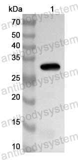 Anti-Human SLC20A1 Polyclonal Antibody