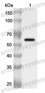 Anti-Human PTPRQ Polyclonal Antibody