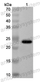 Anti-Human VWA8 Polyclonal Antibody