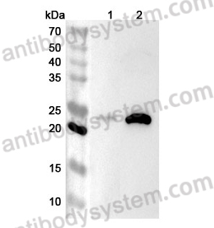 Anti-Human JCHAIN Polyclonal Antibody