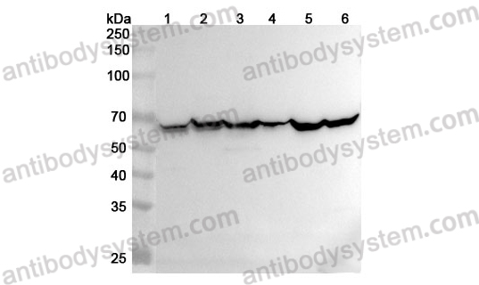 Anti-Human MCCC2 Polyclonal Antibody