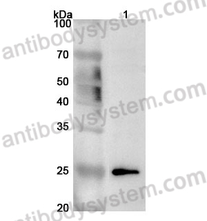 Anti-Human METTL5 Polyclonal Antibody