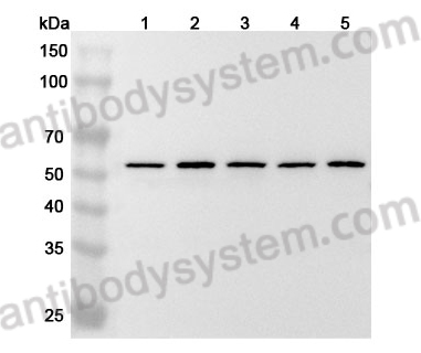 Anti-Human TRNAU1AP Polyclonal Antibody