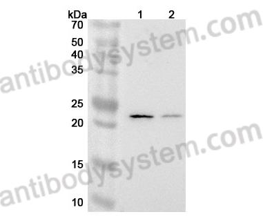 Anti-Human MMAB Polyclonal Antibody