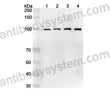 Anti-Human KANK2 Polyclonal Antibody