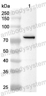 Anti-MID1 Polyclonal Antibody