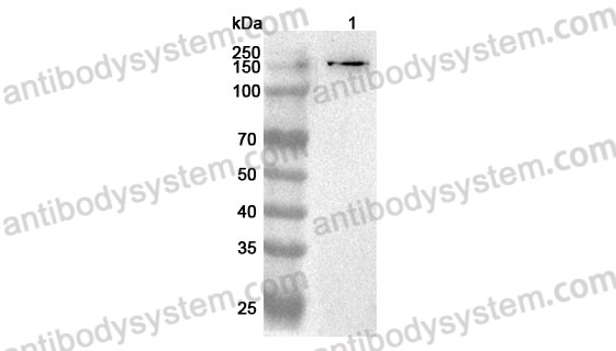 Anti-Mouse MATN2 Polyclonal Antibody