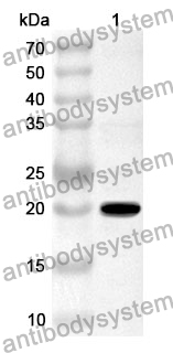 Anti-TNFa/TNF-alpha Polyclonal Antibody