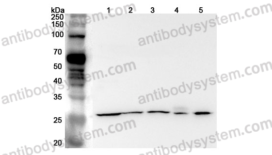 Anti-Mouse APCS Polyclonal Antibody