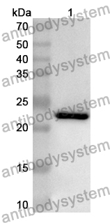 Anti-Mouse RBP4 Polyclonal Antibody