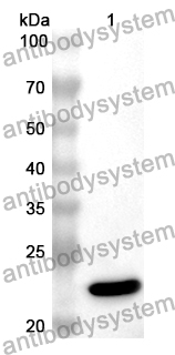 Anti-Mouse S100A8 Polyclonal Antibody