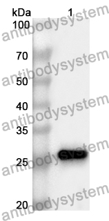 Anti-Mouse IGFBP1 Polyclonal Antibody