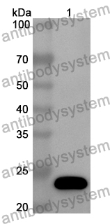 Anti-Mouse CD102/ICAM2 Polyclonal Antibody