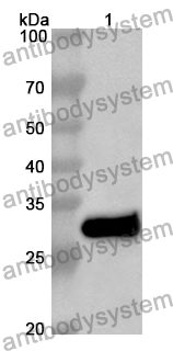 Anti-Mouse CD116/CSF2RA Polyclonal Antibody