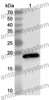 Anti-Mouse IL1RN/IL-1ra/IL1F3 Polyclonal Antibody