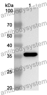 Anti-Mouse CXCL3/GRO-gamma/MIP2-beta Polyclonal Antibody