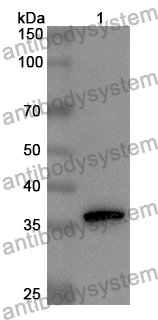 Anti-Mouse BGN Polyclonal Antibody