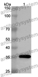 Anti-Mouse FLT4 Polyclonal Antibody