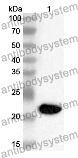 Anti-Mouse LTBR Polyclonal Antibody