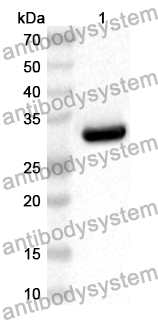 Anti-Mouse IFNGR2 Polyclonal Antibody